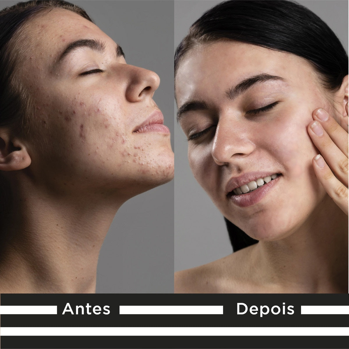 Kit Skincare Facial Skin.A Day – Sérum Clareador Vitamina C 10% Nanoencapsulada, Ácido Hialurônico e Rosa Mosqueta + Gel de Limpeza + Tônico – Luminosidade, Firmeza, Hidratação e Tom Uniforme